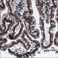 Anti-PTGES2 antibody produced in rabbit HPA020631-100UL