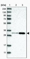 Anti-PTGES2 antibody produced in rabbit HPA020631-100UL