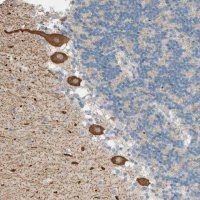 Anti-PTGES3L-AARSD1 antibody produced in rabbit 