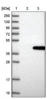 Anti-PTGR1 antibody produced in rabbit HPA036725-100UL