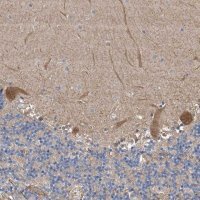 Anti-PTK2 antibody produced in rabbit 
