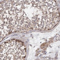Anti-PTK2 antibody produced in rabbit 