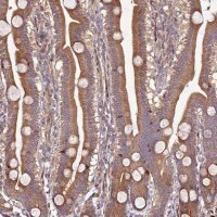 Anti-PTMA antibody produced in rabbit 