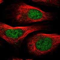Anti-PTMA antibody produced in rabbit 