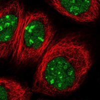 Anti-PTMS antibody produced in rabbit 