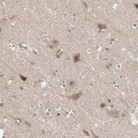 Anti-PTPA antibody produced in rabbit HPA005695-100UL