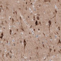 Anti-PTPRD antibody produced in rabbit 