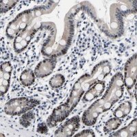 Anti-PTRHD1 antibody produced in rabbit 