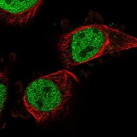Anti-PTRHD1 antibody produced in rabbit 