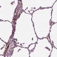 Anti-PTX3 antibody produced in rabbit 