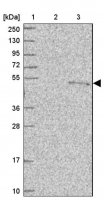 Anti-PUS1 antibody produced in rabbit HPA051636-100UL