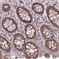 Anti-PUS7L antibody produced in rabbit 