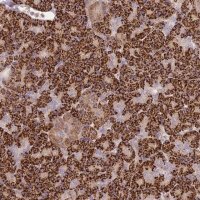 Anti-PVRIG antibody produced in rabbit 