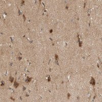 Anti-PXK antibody produced in rabbit 