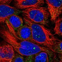 Anti-PXMP4 antibody produced in rabbit 