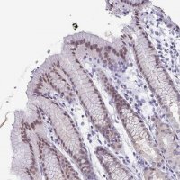 Anti-PYCRL antibody produced in rabbit 