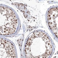 Anti-QRICH1 antibody produced in rabbit 