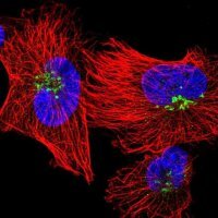 Anti-QSOX1 antibody produced in rabbit 