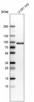 Anti-QSOX1 antibody produced in rabbit 