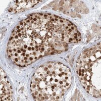 Anti-R3HCC1L antibody produced in rabbit 