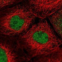 Anti-R3HDM2 antibody produced in rabbit