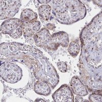 Anti-RAB6A antibody produced in rabbit HPA059131-100UL