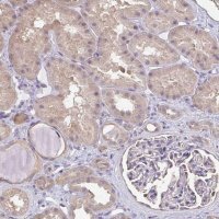 Anti-RABGAP1L antibody produced in rabbit 