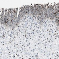 Anti-RAD1 antibody produced in rabbit 