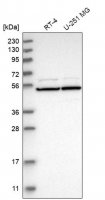 Anti-RAD23A antibody produced in rabbit 