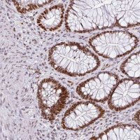 Anti-RAD50 antibody produced in rabbit