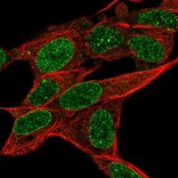 Anti-RADIL antibody produced in rabbit 