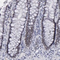 Anti-RAF1 antibody produced in rabbit