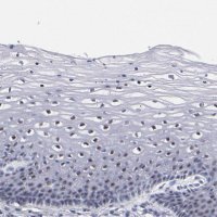 Anti-RAF1 antibody produced in rabbit