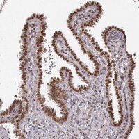 Anti-RAI1 antibody produced in rabbit 
