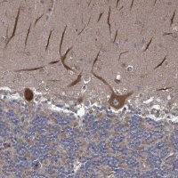 Anti-RALGAPB antibody produced in rabbit 