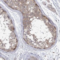 Anti-RALGAPB antibody produced in rabbit 