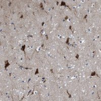 Anti-RAP1GAP2 antibody produced in rabbit HPA022896-100UL