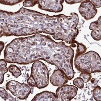 Anti-RAPGEF4 antibody produced in rabbit 