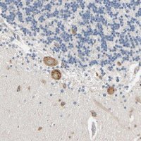 Anti-RARS antibody produced in rabbit 