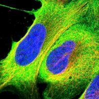 Anti-RASAL1 antibody produced in rabbit 