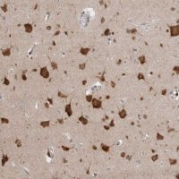Anti-RASAL2 antibody produced in rabbit 
