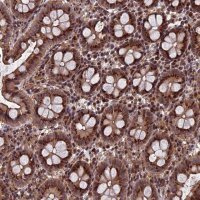 Anti-RASGRF1 antibody produced in rabbit 