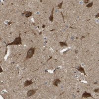 Anti-RASGRF2 antibody produced in rabbit