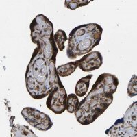 Anti-RASGRF2 antibody produced in rabbit