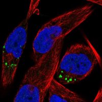 Anti-RASL10B antibody produced in rabbit 
