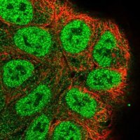 Anti-RASSF2 antibody produced in rabbit