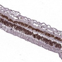 Anti-RB1 antibody produced in rabbit 