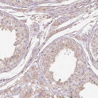 Anti-RB1CC1 antibody produced in rabbit 