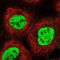 Anti-RBM15 antibody produced in rabbit 