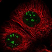 Anti-RBM34 antibody produced in rabbit 